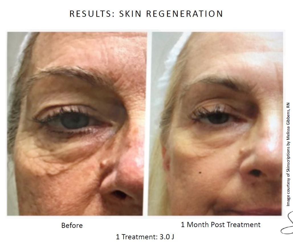 skinscriptions melissa gibbens 3j