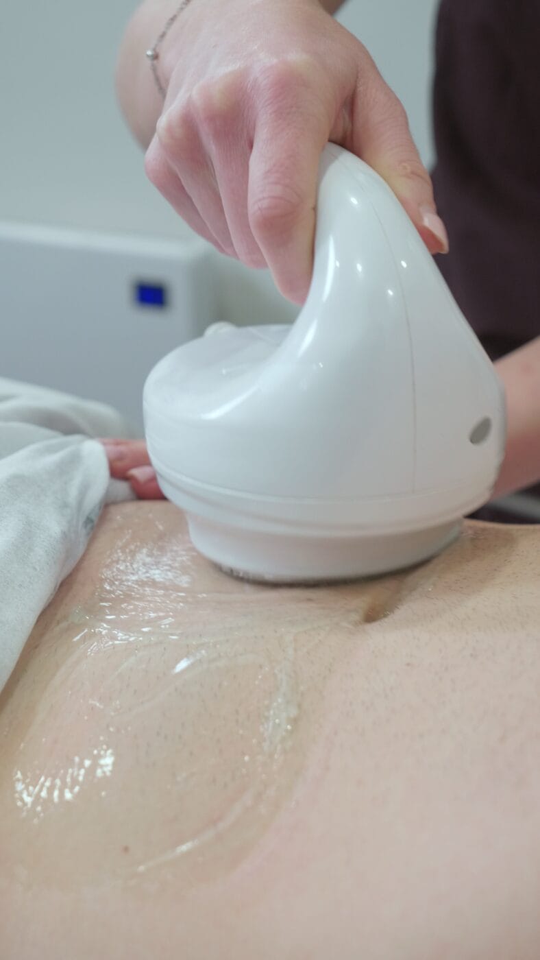 Body sculpting treatment in progress at Dawn Clinic