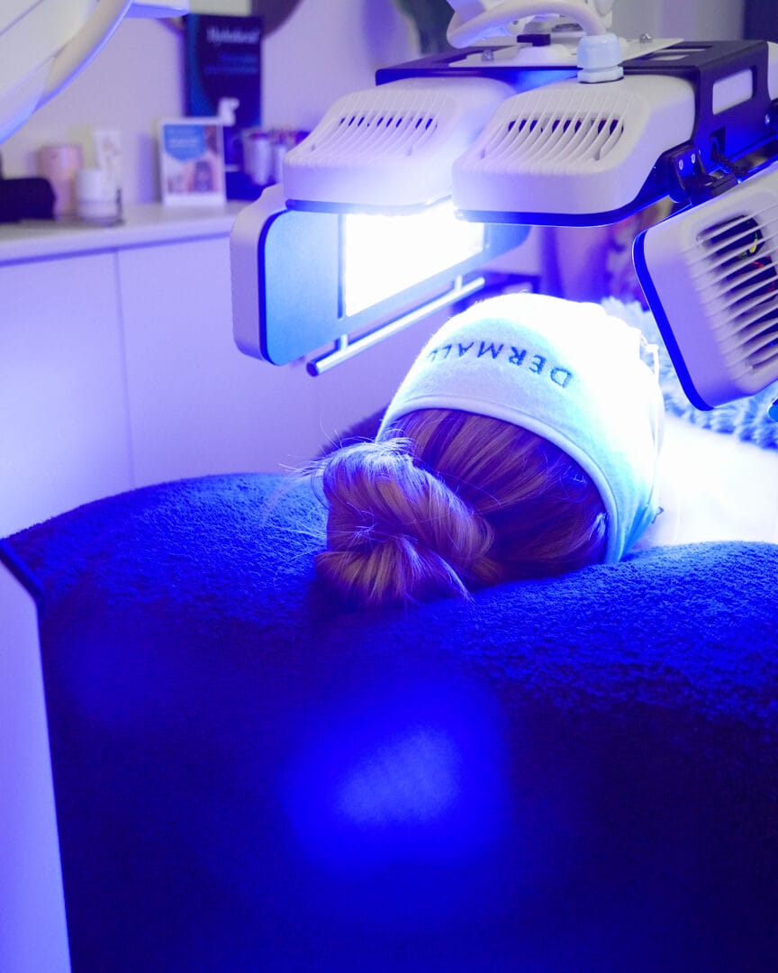 Dermalux blue LED light therapy treatment at Dawn Clinic