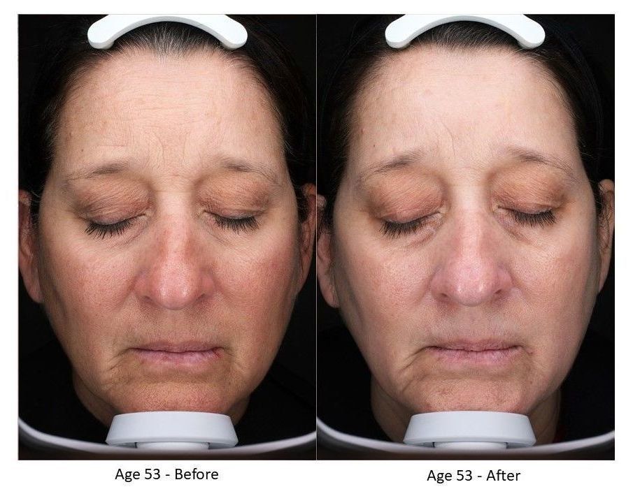 rsz_1rsz_emepelle-pics-53